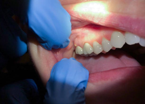 Best Emergency Root Canal Treatment in Dasher, GA