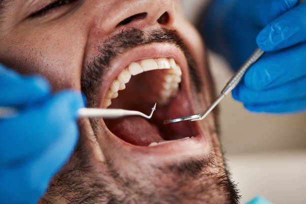 Best Emergency Dentist for Knocked-Out Tooth in Dasher, GA
